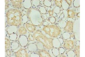 Immunohistochemistry of paraffin-embedded human kidney tissue using ABIN7173734 at dilution of 1:100 (TBCB antibody  (AA 1-244))