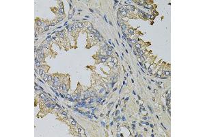 Immunohistochemistry of paraffin-embedded human prostate using LITAF Antibody (ABIN5973182) at dilution of 1/100 (40x lens). (LITAF antibody)
