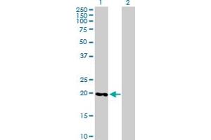 Western Blot analysis of RABL4 expression in transfected 293T cell line by RABL4 MaxPab polyclonal antibody. (RABL4 antibody  (AA 1-186))