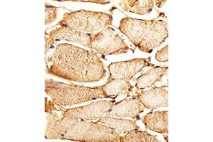 Iunohistochemical analysis of paraffin-embedded H. (MME antibody  (AA 492-525))