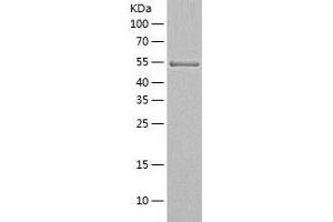 Western Blotting (WB) image for Ribophorin II (RPN2) (AA 23-540) protein (His tag) (ABIN7124877) (Ribophorin II Protein (RPN2) (AA 23-540) (His tag))