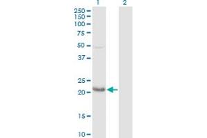 Western Blot analysis of GLO1 expression in transfected 293T cell line by GLO1 polyclonal antibody (A01). (GLO1 antibody  (AA 1-184))