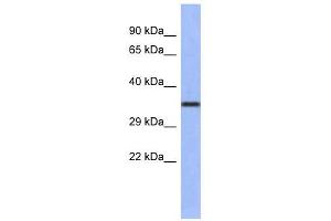 WNT4 antibody used at 1 ug/ml to detect target protein. (WNT4 antibody  (Middle Region))