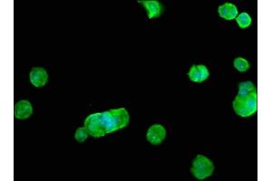 Immunofluorescence staining of MCF-7 cells with ABIN7168018 at 1:100, counter-stained with DAPI. (RHOB antibody  (AA 1-196))