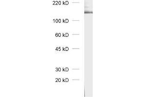 Western Blotting (WB) image for anti-Erythrocyte Membrane Protein Band 4.1 (Elliptocytosis 1, RH-Linked) (EPB41) (AA 1-180) antibody (ABIN1742539)