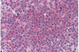 Human Spleen: Formalin-Fixed, Paraffin-Embedded (FFPE) (HYI antibody  (AA 1-218))