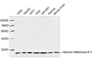 Western blot analysis of cell and tissue lysates using 1 µg/mL Antibodies-Online Rabbit Anti-Histone H2B (Acetyl-K20) Polyclonal Antibody (ABIN398911) The signal was developed with IRDyeTM 800 Conjugated Goat Anti-Rabbit IgG. (Histone H2B antibody  (Lys20))