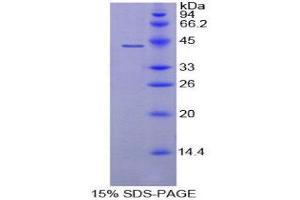 SDS-PAGE (SDS) image for Complement Component 8, beta Polypeptide (C8B) (AA 161-503) protein (His tag) (ABIN2124468) (C8B Protein (AA 161-503) (His tag))