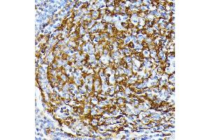 Immunohistochemistry of paraffin-embedded human tonsil using Casein Kinase 1 alpha (Casein Kinase 1 alpha (CSNK1)) antibody (6225) at dilution of 1:100 (40x lens). (CSNK1A1 antibody  (AA 100-200))