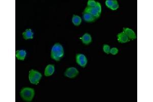 Immunofluorescence staining of PC3 cells with ABIN7154871 at 1:106, counter-stained with DAPI. (HSPA1B antibody  (AA 418-641))