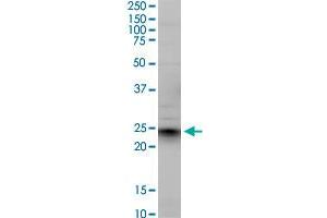 EFNA5 monoclonal antibody (M01), clone 1F12. (Ephrin A5 antibody  (AA 114-203))