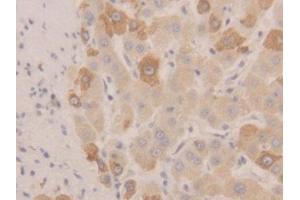 DAB staining on IHC-P; Samples: Human Liver Tissue (NEU1 antibody  (AA 47-415))