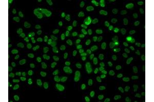 Immunofluorescence analysis of A549 cell using PLCXD2 antibody. (PLCXD2 antibody)
