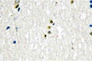 Immunohistochemistry (IHC) analyzes of DNA Ligase I antibody in paraffin-embedded human brain tissue. (LIG1 antibody)