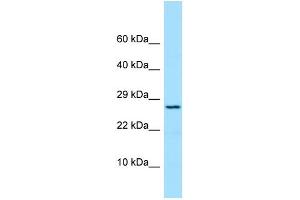 Host: Rabbit Target Name: PRDX4 Sample Type: COLO205 Whole Cell lysates Antibody Dilution: 1. (Peroxiredoxin 4 antibody  (N-Term))