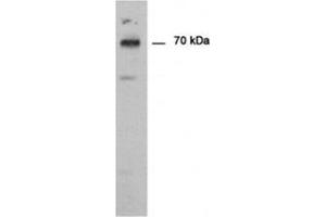 Immunodetection of PAD type 1 using PADI1 antibody in Human epedermis as a 70 kDa protein. (PADI1 antibody)