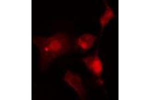 ABIN6275897 staining  Hela cells by IF/ICC. (INA antibody  (Internal Region))