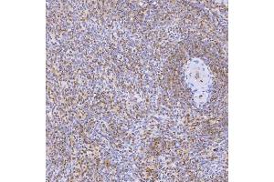 IHC analysis of U1-C/SNRPC using anti-U1-C/SNRPC antibody (ABIN7599016). (SNRPC antibody  (AA 1-159))
