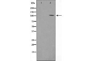 Western blot analysis on COLO205 cell lysate using PSMD2 Antibody，The lane on the left is treated with the antigen-specific peptide. (PSMD2 antibody  (Internal Region))