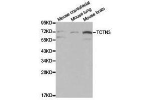 Western Blotting (WB) image for anti-Tectonic Family Member 3 (TCTN3) antibody (ABIN1875046) (TCTN3 antibody)