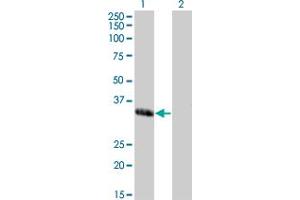 Western Blot analysis of MEOX1 expression in transfected 293T cell line by MEOX1 monoclonal antibody (M03), clone 2E12.
