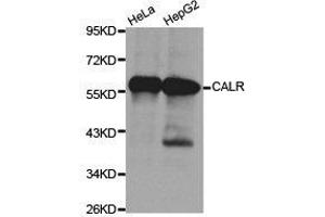 Western Blotting (WB) image for anti-Calreticulin (CALR) antibody (ABIN1871404) (Calreticulin antibody)