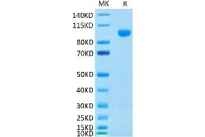 Human MMP-9 on Tris-Bis PAGE under reduced condition.