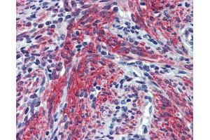 Immunohistochemistry (IHC) image for anti-Periostin (POSTN) (N-Term) antibody (ABIN2776882) (Periostin antibody  (N-Term))