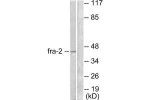 Western Blotting (WB) image for anti-FOS-Like Antigen 2 (FOSL2) (C-Term) antibody (ABIN1848553) (FOSL2 antibody  (C-Term))