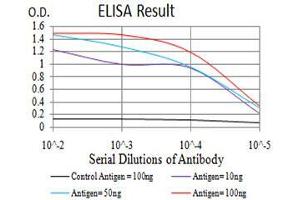 Black line: Control Antigen (100 ng), Purple line: Antigen(10 ng), Blue line: Antigen (50 ng), Red line: Antigen (100 ng), (KDM2B antibody  (AA 457-555))