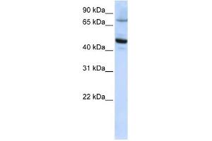 CYP46A1 antibody used at 1 ug/ml to detect target protein. (CYP46A1 antibody  (C-Term))
