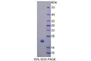 SDS-PAGE (SDS) image for Cyclin-Dependent Kinase 2 Associated Protein 1 (CDK2AP1) (AA 1-115) protein (His tag) (ABIN6239472) (CDK2AP1 Protein (AA 1-115) (His tag))