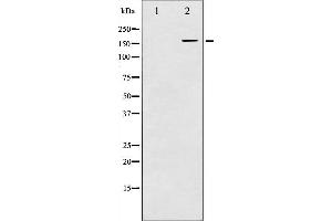 Western Blotting (WB) image for anti-Epidermal Growth Factor Receptor (EGFR) (pTyr1016) antibody (ABIN6256611)