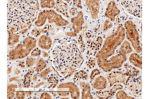 Immunohistochemistry (IHC) image for anti-Arginase, Liver (ARG1) antibody (ABIN5913081) (Liver Arginase antibody)