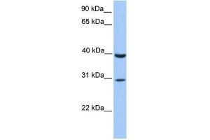 JAZF1 antibody used at 1.