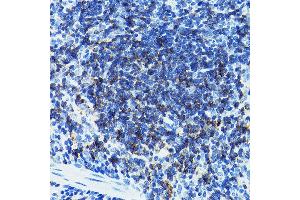 Immunohistochemistry (IHC) image for anti-CD79b Molecule, Immunoglobulin-Associated beta (CD79B) (AA 29-159) antibody (ABIN3022746)