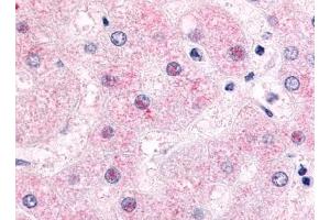 Immunohistochemical staining of Liver (Hepatocytes) using anti- NR0B2 antibody ABIN122347 (NR0B2 antibody)
