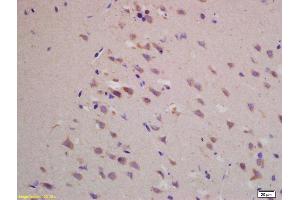 Formalin-fixed and paraffin embedded rat brain labeled with Rabbit Anti BACE1/ASP2 Polyclonal Antibody, Unconjugated (ABIN725705) at 1:200 followed by conjugation to the secondary antibody and DAB staining (BACE1 antibody  (AA 401-501))
