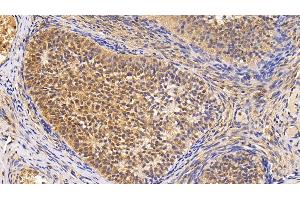 Detection of Surv in Human Ovary Tissue using Monoclonal Antibody to Survivin (Surv) (Survivin antibody  (AA 1-142))
