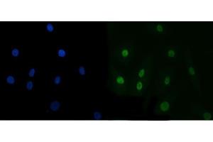 IF analysis of TRBP/TARBP2 using anti-TRBP/TARBP2 antibody (ABIN7600548). (TARBP2 antibody  (AA 20-366))