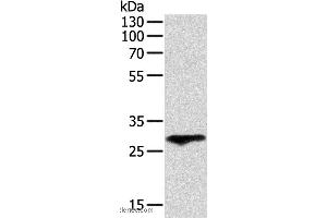 Western blot analysis of Human fetal lung tissue, using F3 Polyclonal Antibody at dilution of 1:400