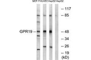 Western blot analysis of extracts from MCF-7/HuvEc/HepG2 cells, using GPR19 Antibody.