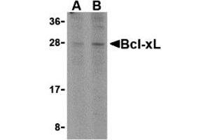 Western Blotting (WB) image for anti-BCL2-Like 1 (BCL2L1) (C-Term) antibody (ABIN1030287) (BCL2L1 antibody  (C-Term))