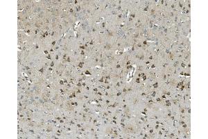 IHC analysis of Thioredoxin 2/TXN2 using anti-Thioredoxin 2/TXN2 antibody (ABIN7602149).