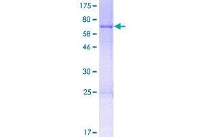 Image no. 1 for NOP2/Sun Domain Family, Member 5 (NSUN5) (AA 1-429) protein (GST tag) (ABIN1313085) (NSUN5 Protein (AA 1-429) (GST tag))