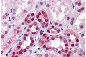 Immunohistochemistry (Formalin-fixed Paraffin-embedded Sections) (IHC (fp)) image for anti-ELAV (Embryonic Lethal, Abnormal Vision, Drosophila)-Like 1 (Hu Antigen R) (ELAVL1) (AA 1-101) antibody (ABIN574241)