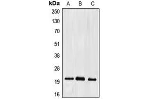 Western blot analysis of Ephrin A2 expression in HepG2 (A), mouse liver (B), rat kidney (C) whole cell lysates. (Ephrin A2 antibody  (C-Term))