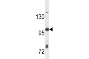 Anti-TLR7 antibody western blot analysis in Ramos lysate (TLR7 antibody  (AA 98-128))