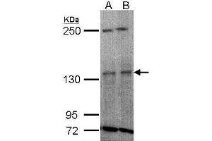 WB Image Sample(30 ug whole cell lysate) A:H1299 B:HeLa S3, 5% SDS PAGE antibody diluted at 1:1000 (TYK2 antibody)