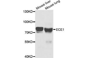 Western Blotting (WB) image for anti-Endothelin-Converting Enzyme 1 (ECE1) antibody (ABIN1876839) (ECE1 antibody)